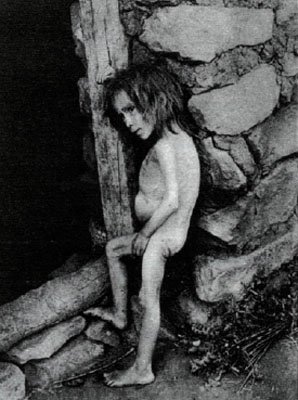 Russian girl, victim of the devastating famine